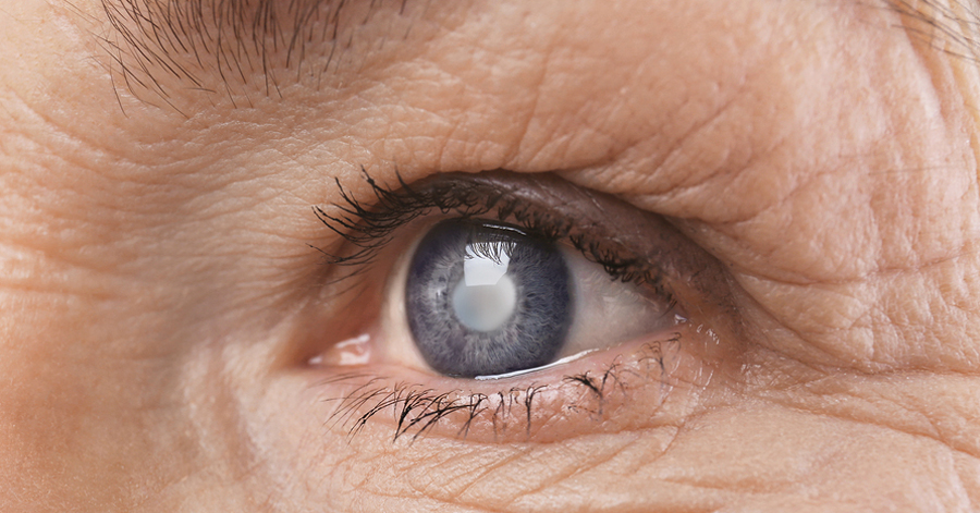 Bringing 5 of the Most Common Eye Diseases into Focus